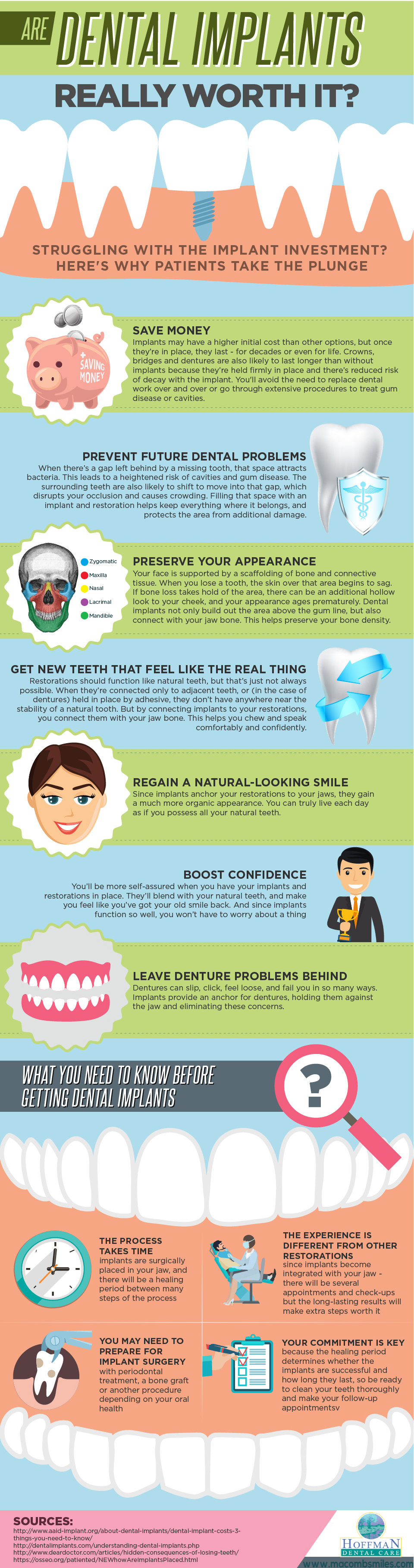 Macomb dental implants infographic