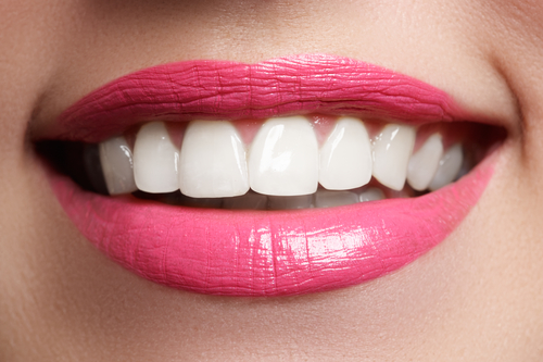 woman's smile with straight teeth