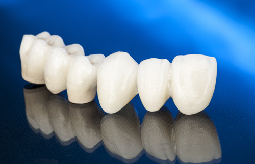 set of veneers on a blue background