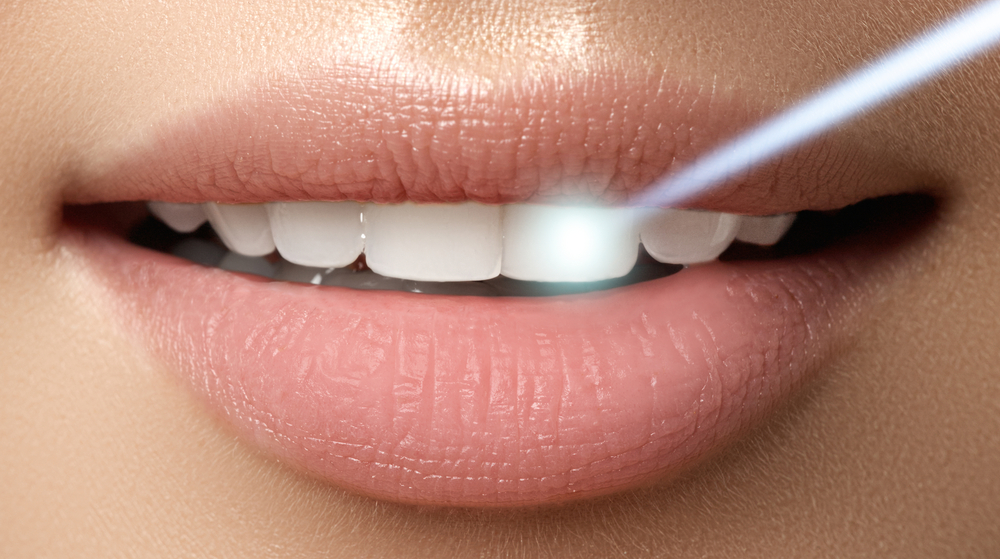 Pain-Free Laser Dentistry