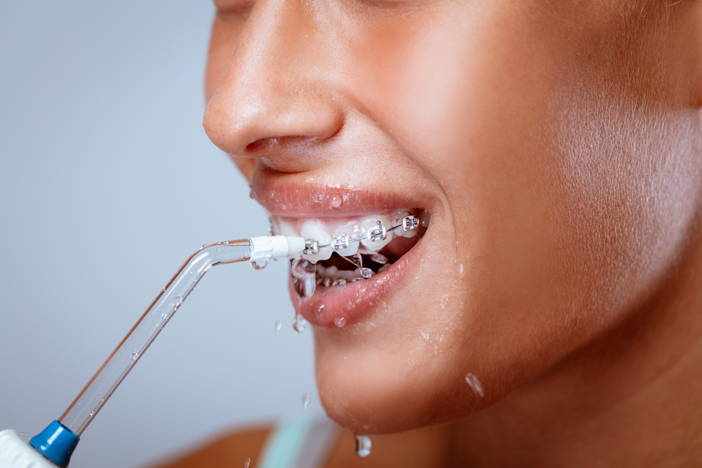 Water Flosser Vs String Floss