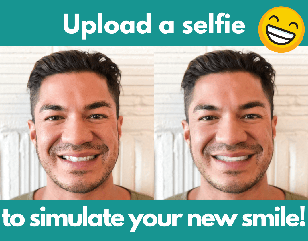 online invisalign smile simulation tool